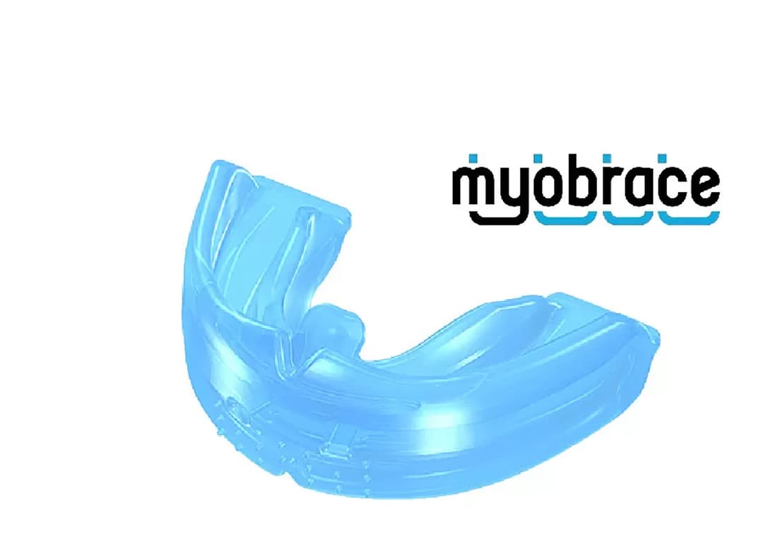 04 矯正治療開始の写真